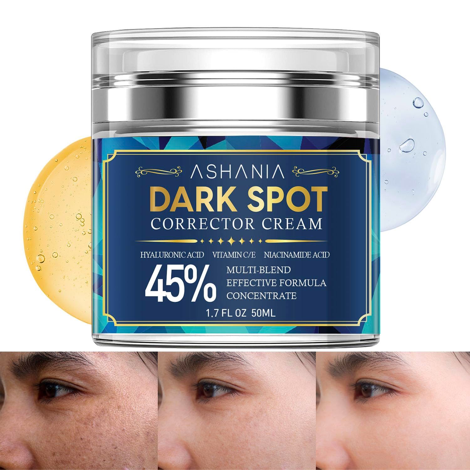 Ashania Dark Spot Corrector for Face and Body: Dark Spot Remover for Face, Age spot Corrector for face - Sun Spot Corrector for All Skin Types