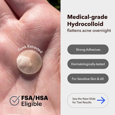 AVARELLE Acne Cover Patches, FSA HSA Eligible Hydrocolloid Pimple Patches for Face with Tea Tree Oil, Korean Skincare Zit Patches for Face | FSA HSA Store Eligible Items | Vegan, Cruelty-free