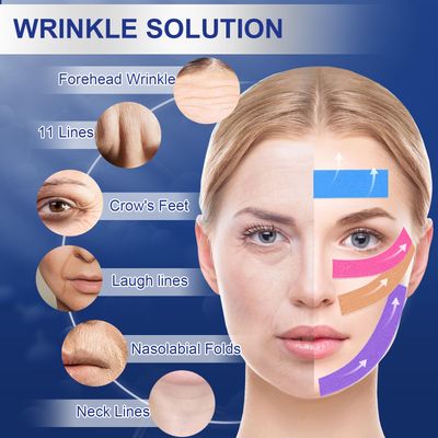 Anti-Wrinkle Tape | Facial Myofascial Lift Tape for Skin Firming, Toning &amp; Tightening | Lift Tape for Face, Neck &amp; Forehead | Smooths Wrinkles, Lifts Skin Anti-Aging Face Patches (4 Colors Assorted)