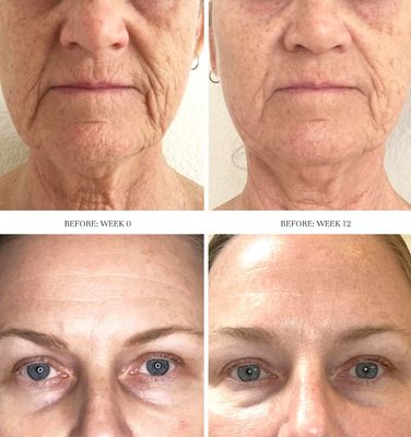 City Beauty Dermal Reset Exfoliating Concentrate - AHA Lactic Acid Daily Facial Exfoliant - Solution For Wrinkles, Texture, Discoloration, & Pores - Anti-Aging Cruelty-Free Skin Care