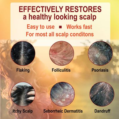 Folliculitis Treatment Clarifying Serum with Salicylic Acid to Remove Build Up, For Normal to Oily Scalp. Prone to Folliculitis, Dandruff, Itchy &amp; Flaky Scalp, Seborrheic Dermatitis Paraben-Free.