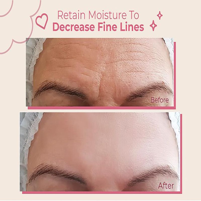 Forehead Wrinkle Patches Reusable | Forehead Wrinkles Treatment | Patches For Wrinkles | Non Invasive Reusable Wrinkle Smoothers | Works Great with an Eye Wrinkle Patches Kit and Face Tape | 2 Patches