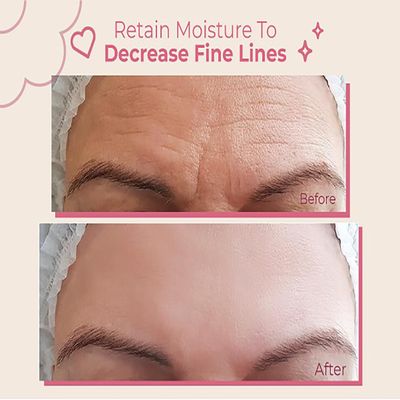 Forehead Wrinkle Patches Reusable | Forehead Wrinkles Treatment | Patches For Wrinkles | Non Invasive Reusable Wrinkle Smoothers | Works Great with an Eye Wrinkle Patches Kit and Face Tape | 2 Patches