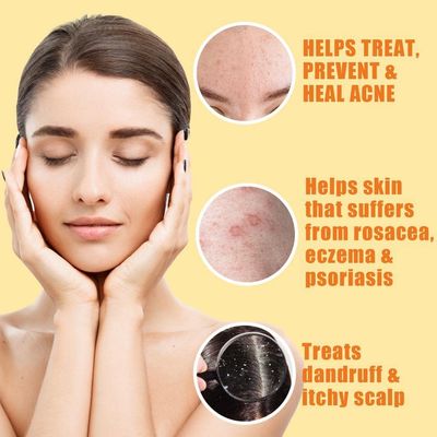 10% Sulfur Soap Cleansing Bar for Face & Body - All Natural Facial Cleanser for Acne, Oily Skin - Healing Skincare Blend of Lemongrass, Tea Tree Essential Oil, Vitamin E, Coconut Milk - Made in USA