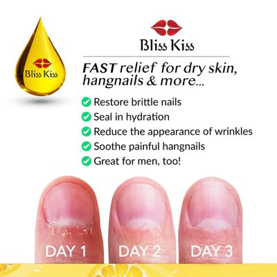 Bliss Kiss | Crisp Fragrance | Nail Oil Cuticle Dropper w/Vitamin E & JojobaNail Strengthener Nail Growth Serum for Brittle Peeling Breaking Thin Nails | 0.5oz |