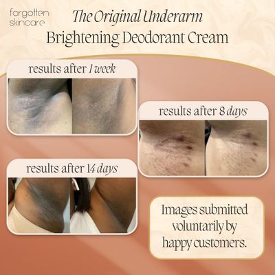 Forgotten Skincare The Original Underarm Brightening Deodorant Cream For Dark Underarms Treatment, Body Odor Eliminator For Women &amp; Men, Ingrown Hair Treatment, Vitamin C &amp; Salicylic Acid