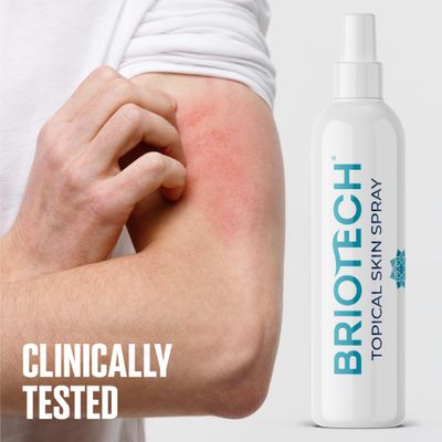 BRIOTECH Topical Skin Spray, Hypochlorous Acid Spray for Body & Face, Eyelid Cleanser, HOCl Facial Mist, Support Against Irritation, Calm Redness, Soothe Foot & Scalp, Stocking Stuffer, 8 fl oz, 1 ct
