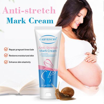 Ezyuanchly Stretch Mark Cream for Women,Scar Cream Body Moisturizer, Reduce The Look of Scars and Stretch Marks,Body Tightening Cream for Scars &amp; Stretchmarks, All Skin Types