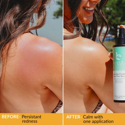 Beauty by Earth After Sun Cooling Aloe Vera Spray - USA Made With Organic Aloe Vera, Fast Absorbing After Sun Care for Sunburn Relief, Skin Cooling Spray, Sunburn Treatment Spray Lotion for Body