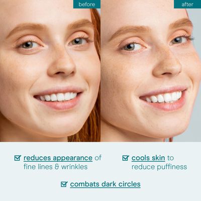 Baebody Eye Gel, Advanced Cooling Under Eye Cream For Dark Circles - Eye Cream for Puffiness and Bags under Eyes - Eye Cream Anti Aging &amp; Hydrating, Beauty Gifts for Women