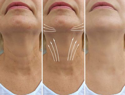 AminoGenesis N.E.C.K Control: Neck Lifting, Firming And Retracting Cream