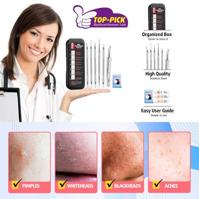 Cbiumpro Blackhead Remover Tools, Pimple Popper Tool Kit, Blackhead Extractor Tool, Zit Popper Tool, Professional Pimple Extractor Tool for Blackhead, Acne, Whitehead, Comedone on Nose - with Case