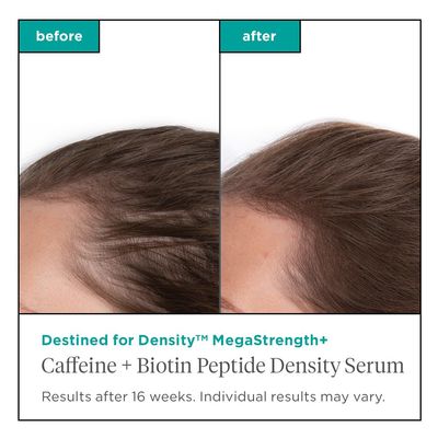 Briogeo Destined For Density MegaStrength+ Caffeine + Biotin Peptide Density Serum, Increases Hair Thickness and Density, Fast-Absorbing & Non-Greasy, Fragrance-Free, Vegan, Cruelty-Free, 1.5 fl oz