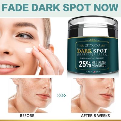 CITYGOO Dark Spot Remover for Face and Body, Corrector Cream, Natural Ingredient,Enriching Skin Care For All Skin Tones - Melasma, Freckle, Sun Spot Remover &amp; Blemish Reducer-1.7 FL OZ