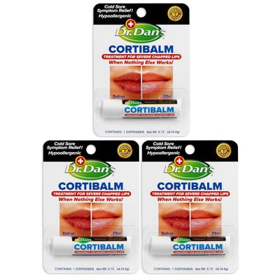 Dr. Dan&#39;s Cortibalm -3 Pack -for Dry Cracked Lips - Healing Lip Balm for Severely Chapped Lips- Designed for Men, Women and Children