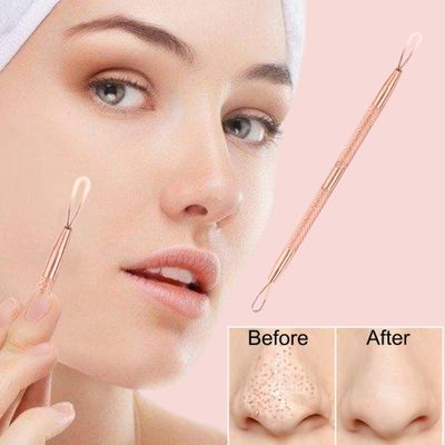 2 Professional Stainless Steel Blackhead Remover Blemish Extractor Tool - Acne Skin Nose Face Tzone Whitehead Zit Pimple Popper Comedone Pustule Removal Double Ended 2 in 1 Nonslip