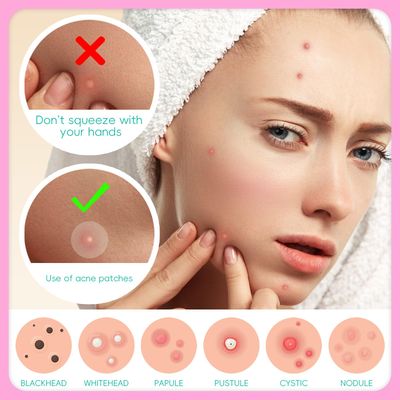 EFLY Pimple Patches for Face, Acne Patches Hydrocolloid with Tea Tree Oil, Salicylic Acid &amp; Calendula Oil, 2 Sizes Invisible for Makeup Zit Patches Dots (324)