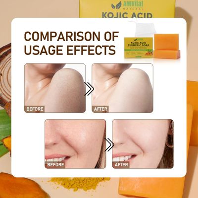 AMVital Turmeric Kojic Acid Soap Bars with Vitamin C, Retinol, Collagen, Hyaluronic Acid, Shea Butter - Kojic Acid and Turmeric Soap for Dark Spots - Turmeric Kojic Acid Cleansing Soap (2 Pack)