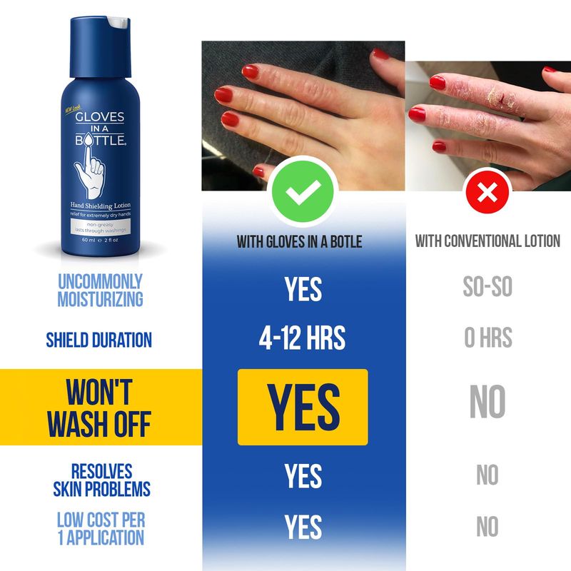 Gloves In A Bottle Shielding Lotion - GREAT for Dry Itchy Skin! Grease-less and Scent FREE! (2oz-60ml)