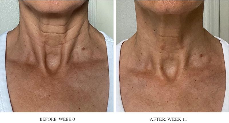 City Beauty Ultra-Firming Dry Oil - Neck &amp; Dcolletage Treatment - Hydrate &amp; Lift - Solution for Crepey Skin, Sagging, &amp; Wrinkles - Non-Greasy Formula - Anti-Aging Cruelty-Free Skin Care
