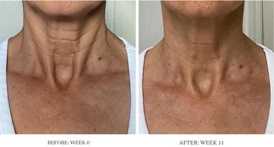 City Beauty Ultra-Firming Dry Oil - Neck & Dcolletage Treatment - Hydrate & Lift - Solution for Crepey Skin, Sagging, & Wrinkles - Non-Greasy Formula - Anti-Aging Cruelty-Free Skin Care
