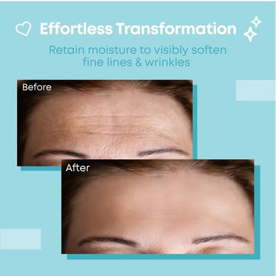 Forehead Wrinkle Patches Reusable | Non-Invasive Wrinkle Treatment for Fine Lines | Works with Face Lift Tape and Eye Patch Kits | Long-Lasting, Gentle Skin Care Solution |