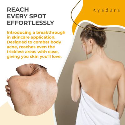 AYADARA Acne Treatment Body Spray with 2% Salicylic Acid, Tea Tree Scent, for All Hair Types, Soothing and Moisturizing, 3-Pack
