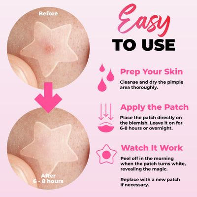 260Pcs Cute Pimple Patches for Face - Hydrocolloid Acne Patches, Zit Patches - Blemish Patches for Face Skin Care - Star, Heart, Cloud, Moon, Glitter & Regular, 7 Colors, 2 Sizes Stickers