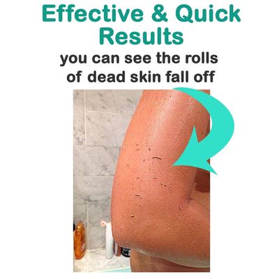 Elbahya Exfoliating Mitt Body Kessa Hammam - Body Tool Remover of Dead & Dry Skin or Keratosis Pilaris, Made of 100% Viscose Fiber (White Pack of 1)