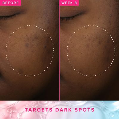 Farmacy 3% TXA Toner for Face - Brightening Face Toner for Oily Skin - Liquid Exfoliant with Azelaic Acid + 5% PHA to Target Visible Dullness + Help Reduce Uneven Skin Tone (120ml)