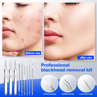 Blackhead Remover Pimple Popper Tool Kit 10PCS Professional Stainless Steel Pimple Extractor for Removing Pimples, Zit on Face - Acne Removal Kit with Case Magnifier