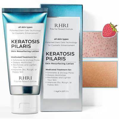 Keratosis Pilaris Lotion with Glycolic Acid, AHA &amp; BHA Exfoliating | Strawberry Legs, KP &amp; Ingrown Hair Treatment | Bumpy Skin Body Lotion | Moisturizing Cream for Redness, Dry, Rough &amp; Flakey Skin