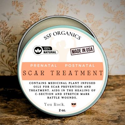 SSF Organics Scar Treatment for Stretch Marks, C-Section Recovery Must Haves - Deeply Moisturize with Calendula, Castor, Shea - Advanced Scar Treatment for Mama Related Wounds