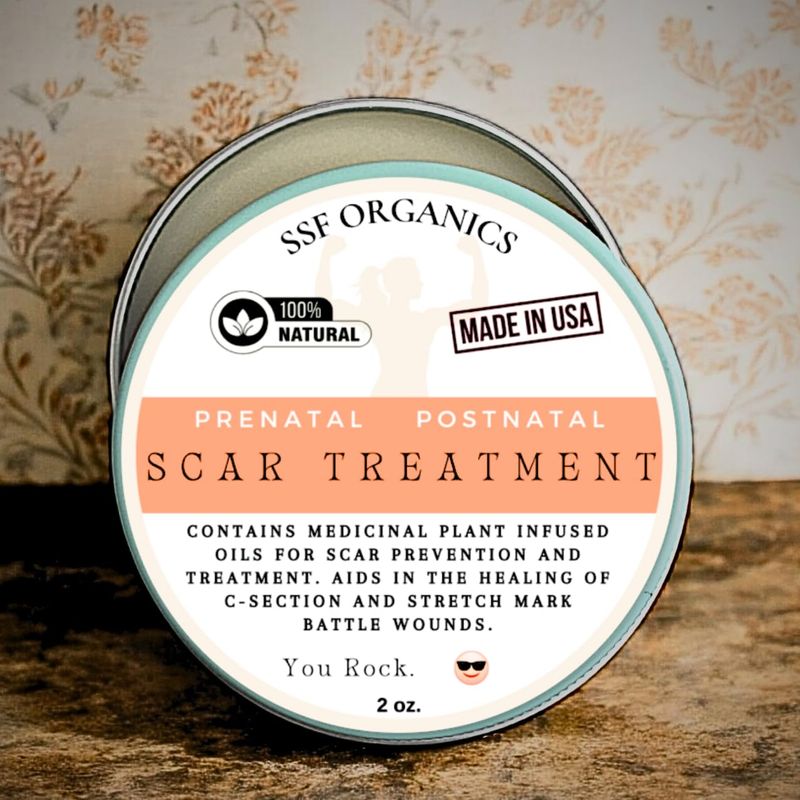 SSF Organics Scar Treatment for Stretch Marks, C-Section Recovery Must Haves - Deeply Moisturize with Calendula, Castor, Shea - Advanced Scar Treatment for Mama Related Wounds