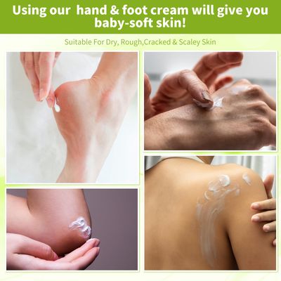 nbc BeautiLab Foot Callus Remover, Hand & Foot Cream, Lotion for Extremely Dry Skin, Athletes Foot Treatment, Pedicure Foot Spa Products for Dry Hands, Cracked Feet, Rough and Dry Skin, 250ml Lemon