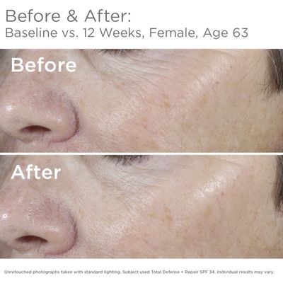SkinMedica Total Defense + Repair SPF 34 Sunscreen for Face. This Lightweight, Facial Sunscreen is Ideal for Oily and/or Combination Skin, 2.3 Oz