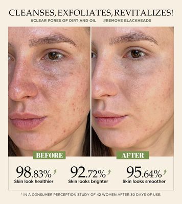 Revitalizing Exfoliation Face Scrub with Vitamin C and Turmeric - Gentle Exfoliating Face Wash for Blackheads, Pore Dirt & Dark Spots - Acne Control Facial Scrub for Oily & Acne-Prone Skin, 4.23 Fl Oz