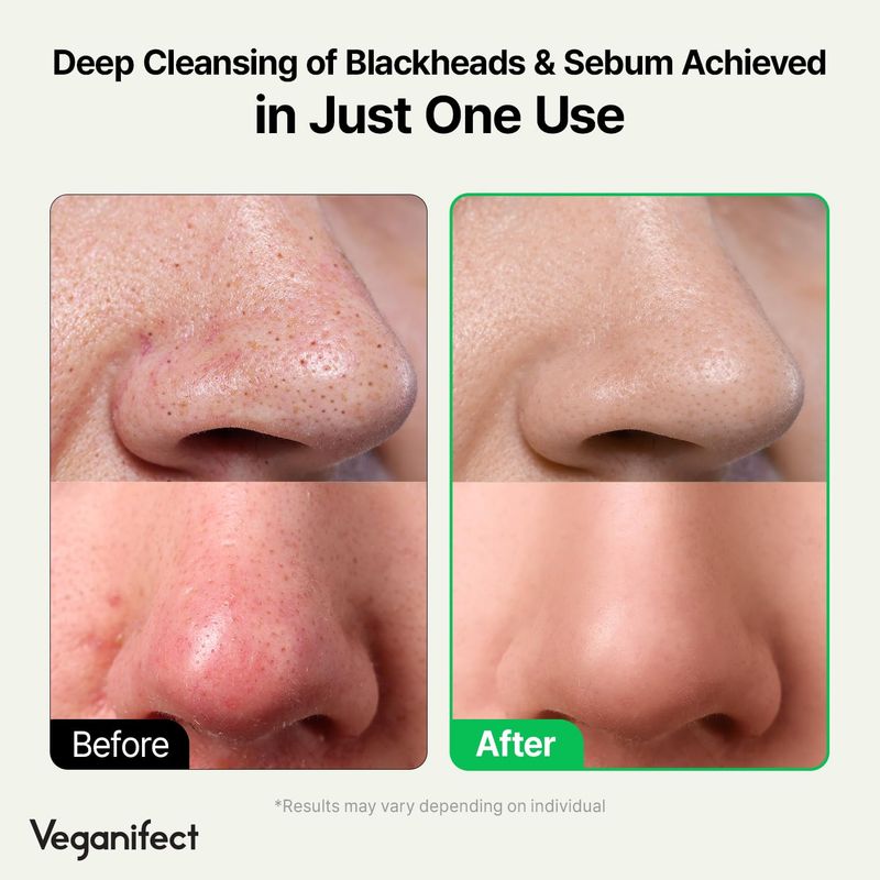 VEGANIFECT LHA Deep Cleansing Oil, Makeup, Blackhead and Whitehead Remover, Korean Skin Care, Vegan, 6.93 Fl Oz