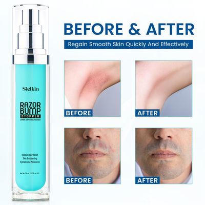Sielkin Ingrown Hair Treatment: Razor Bumps Stopper for Women and Men Upgraded Formula