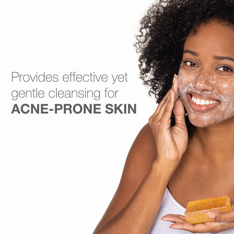 Neutrogena Facial Cleansing Bar Treatment for Acne-Prone Skin, Non-Medicated &amp; Glycerin-Rich Formula Gently Cleanses without Over-Drying, No Detergents or Dyes, Non-Comedogenic, 3.5 oz