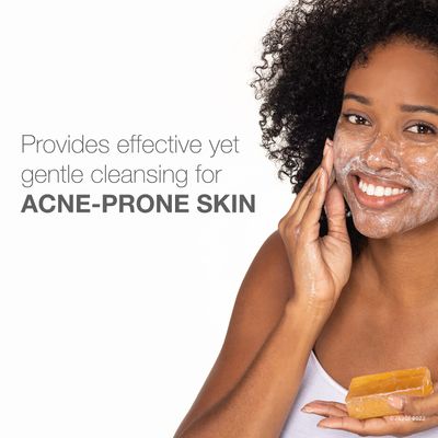 Neutrogena Facial Cleansing Bar Treatment for Acne-Prone Skin, Non-Medicated & Glycerin-Rich Formula Gently Cleanses without Over-Drying, No Detergents or Dyes, Non-Comedogenic, 3.5 oz