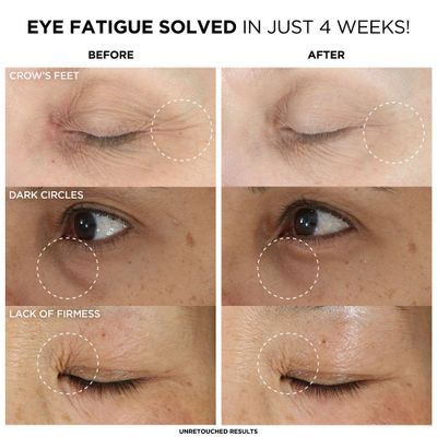 IT Cosmetics Confidence in an Eye Cream, Anti Aging Eye Cream for Dark Circles, Crow's Feet, Lack of Firmness &amp; Dryness, 48HR Hydration with 2% Super Peptide Concentrate, for Day + Night