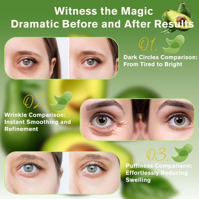 Lktvys Eye Pad Mask 120 PCS (Avocado 2 PACK)- Eye Pads Reduce Dark Circles, Puffiness, Wrinkles, And Bags, Eye Pads Suitable for All Skin Types, Especially Dry, Sensitive, and Nourishing Eye Skin