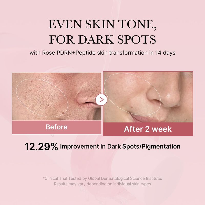Medicube PDRN Pink Peptide Toner I Pink Glow Toner for Skin Boosting, Soothing and Calming, Uneven Skin Tone, Rose PDRN &amp; Peptide &amp; Niacinamide, Korean Skin Care (250ml / 8.45 fl. oz.)