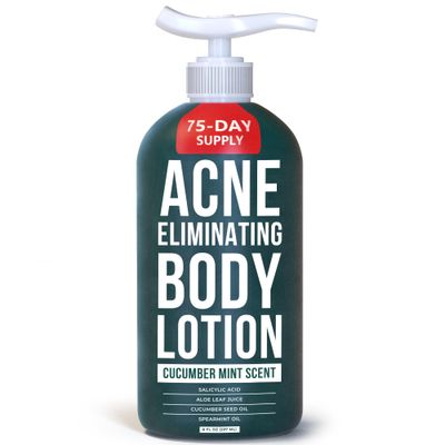 TreeActiv Acne Eliminating Body Lotion, 8 fl oz, Salicylic Acid Lotion, Salicylic Acid Body Acne Treatment, Back Acne Treatment Cream for Women and Men, Acne Lotion for Body, Zit Cream with 2000+ Uses