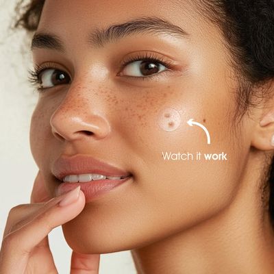 leffo 480 Counts Pimple Patches 3 Size Acne Patches - Hydrocolloid Patches for Covering Zits and Blemishes - Spot Stickers with Salicylic Acid - Tea Tree Oil &amp; Centella Asiatica