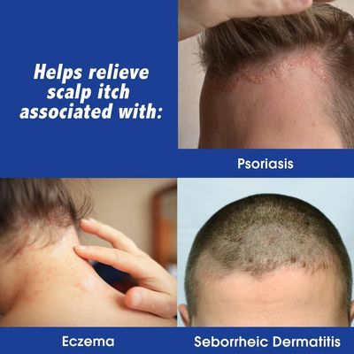 Scalpicin Max Strength Scalp Itch Treatment, 1.5 Ounce (Pack of 4)