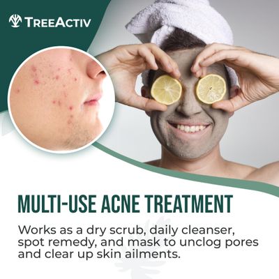 TreeActiv Four-in-One Acne Treatment, Exfoliating Sulfur Acne Face Wash, Bentonite Clay Face Mask &amp; Acne Spot Treatment, Pore Clarifying Facial Scrub for Adult, Teens, Women, &amp; Men, 250+ Treatments
