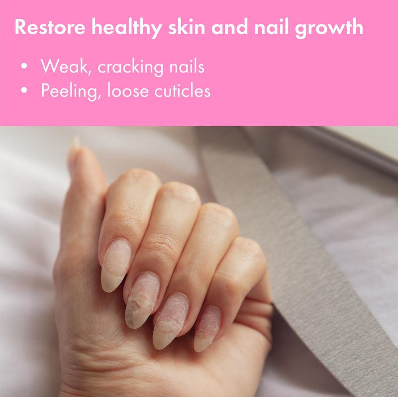 Nail Clearing Gel - Promotes healthy skin and nail growth - Apple &amp; Sugar extract - 0.5 fl oz