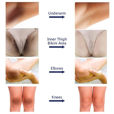 Intimate Areas Skin Lightening Bleaching Cream for Body Sensitive Intimate Area, Private Parts, Underarm, Knees, Elbows, Inner Thigh, Bikini Areas,Skin Whitening Cream Dark Spot Remover.